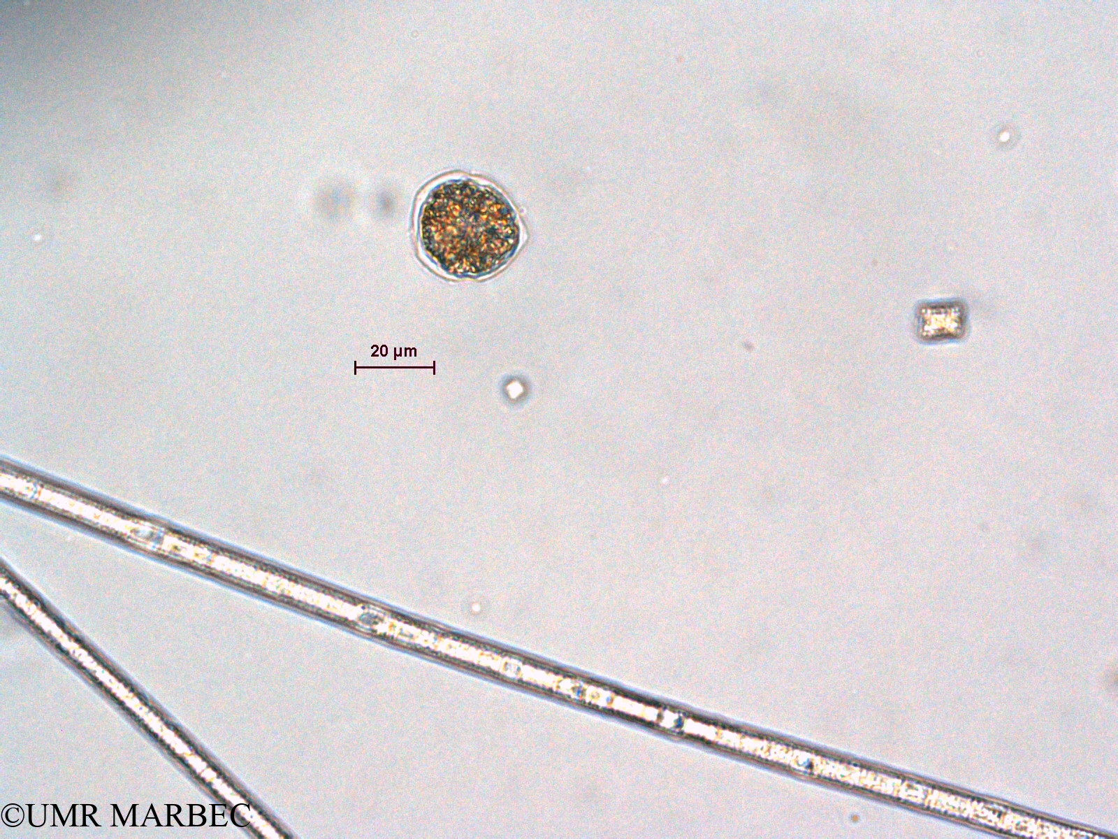 phyto/Scattered_Islands/all/COMMA April 2011/Scrippsiella spp  (ancien Dino g cf protoperidinium)(copy).jpg